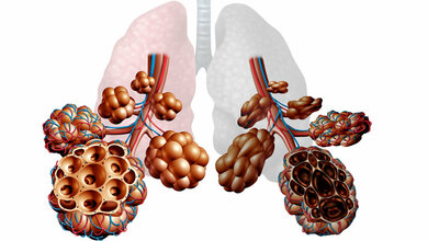 Nutzung von epigenetischem Profiling bei COPD