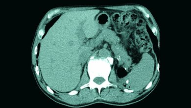 Anomalien und Normvarianten