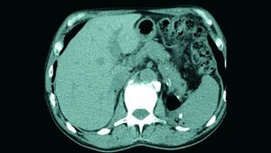 Anomalien und Normvarianten