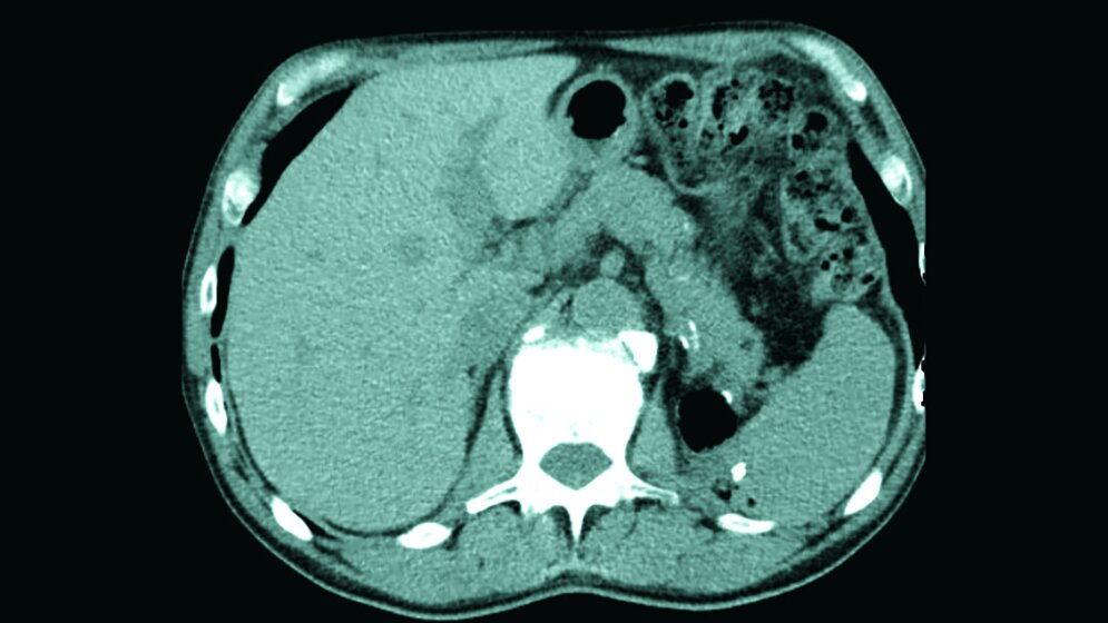 Anomalien und Normvarianten
