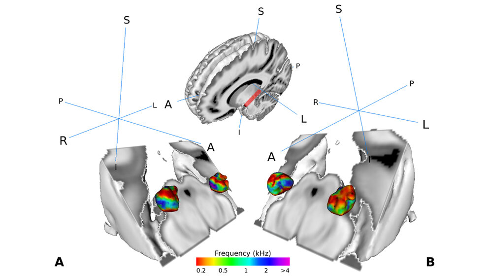 medialer_Kniehoecker_TU_Dresden.jpg medialer Kniehöcker