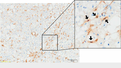 Immunhistochemische_Anfaerbung_des_Botenstoffs_BMP_9_braun_in_einem_Gefrierschnitt_humaner_Leber_UMM.jpg Immunhistochemische Anfärbung des Botenstoffs BMP-9