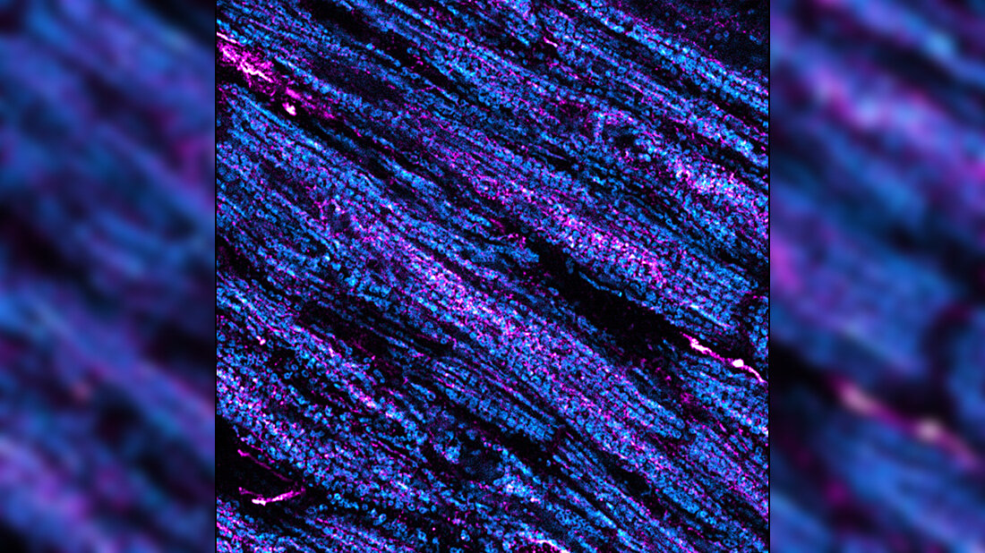 Mikroskopische Aufnahme von Gewebestrukturen in leuchtenden Blau- und Violetttönen, die feine, faserartige Details zeigen.