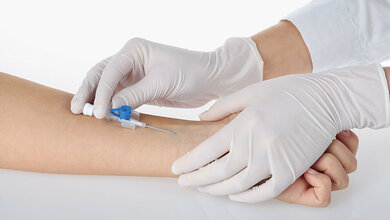 Delegation von ärztlichen Leistungen an MTA