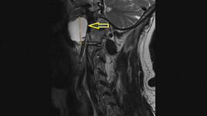 Anomalien und Normvarianten