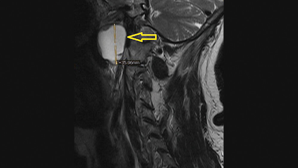 Bildgebende Verfahren Anomalien und Normvarianten