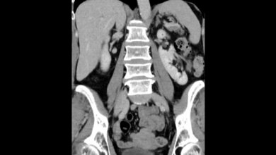 Titelbild zum Fachbeitrag zur Bildgebung bei kongenitalen Anomalien, speziell Nierenmalrotation