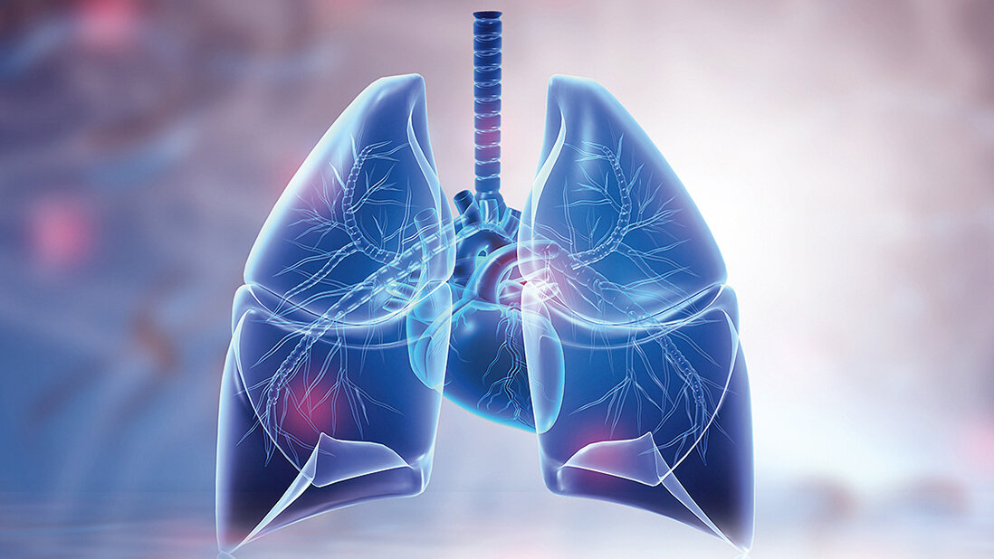 Fujifilm erweitert Portfolio