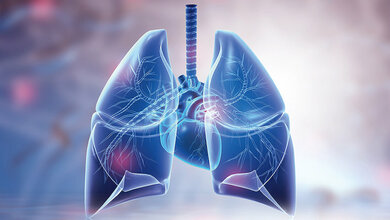 Fujifilm erweitert Portfolio