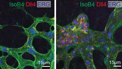 fluoreszenzmarkierte Netzhaut 