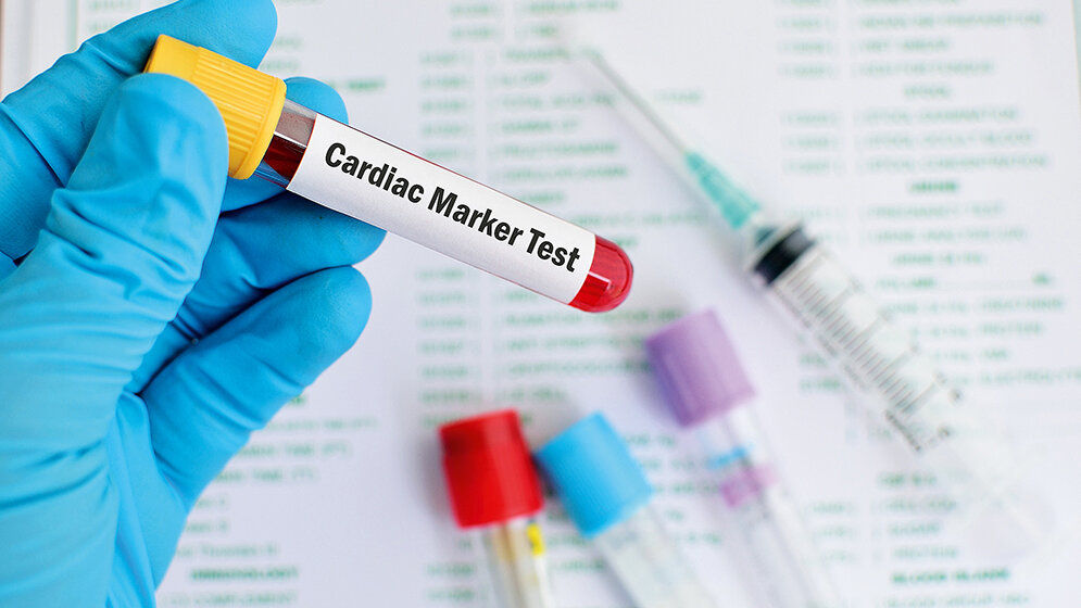 Labordiagnostik von Herzmuskelschädigungen