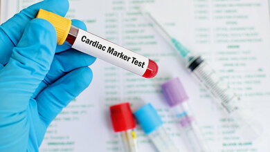 Labordiagnostik von Herzmuskelschädigungen