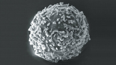 Lymphocytes with hair-like projections