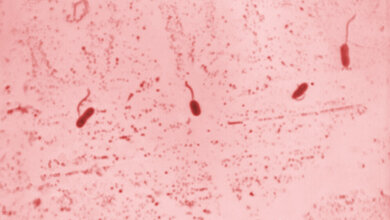 Abb1_Cholera.jpg 308 epidemische Ausbrüche Cholera