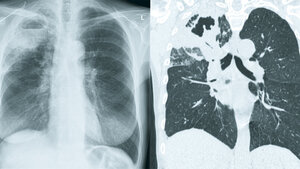 Pneumologie