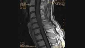 Bildgebende Verfahren
