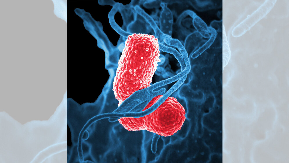 Klebsiella pneumoniae
