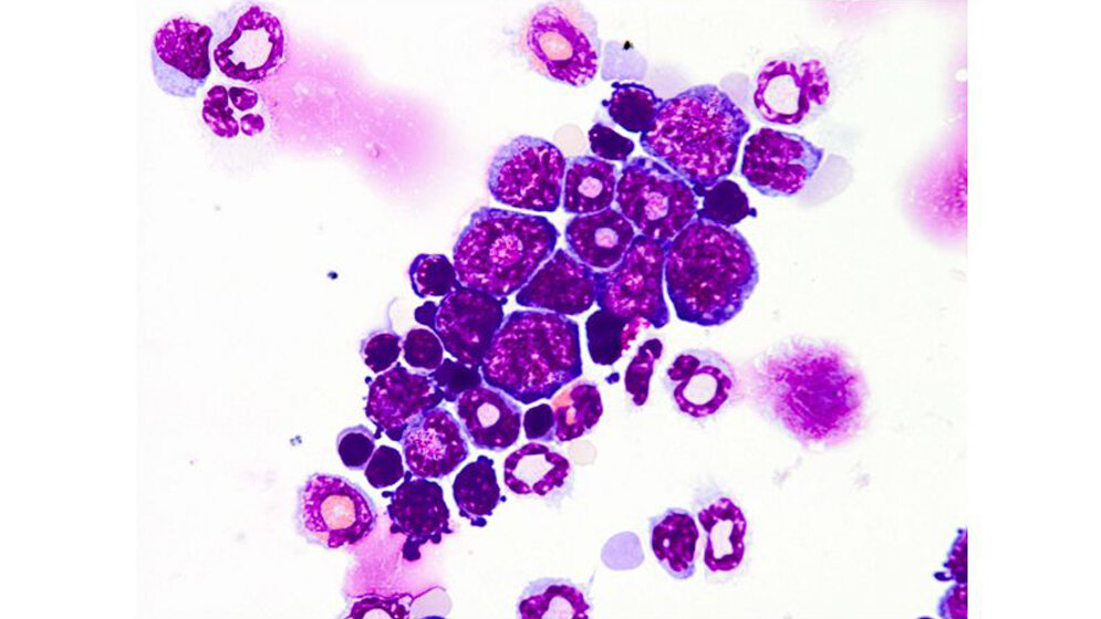 Knochenmarkzellen_der_Maus_Zytospin_May_Gruenwald_Giemsa_Faerbung_Quelle_PEI.jpg Knochenmarkzellen der Maus