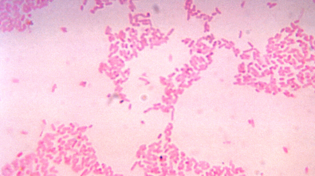 Bacteroides_thetaiotaomicron_CDC_Dr_V_R_Dowell_Jr.jpg Bacteroides thetaiotaomicron