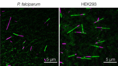 Mikrotubuli sichtbar machen