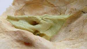 Titelbild zum Fachbeitrag zu Felsenbeinfrakturen bei Schädel-Hirn-Traumata