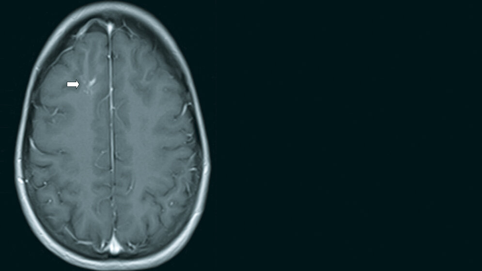 Anomalien und Normvarianten