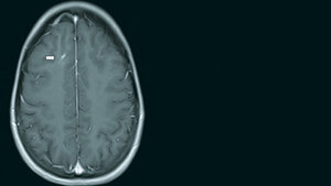 Anomalien und Normvarianten