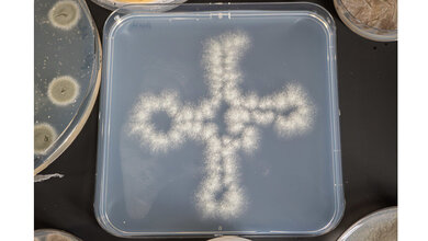 Aspergillus fumigatus