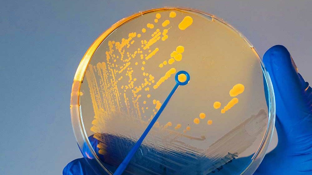 Cholerabakterien.jpg Cholerabakterien