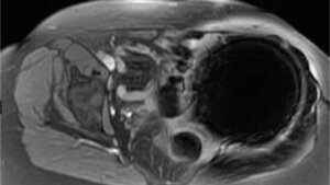 Bildgebende Verfahren