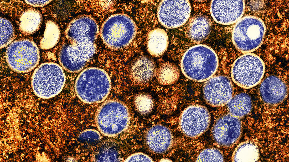 Aufnahme von Mpox-Viruspartikeln