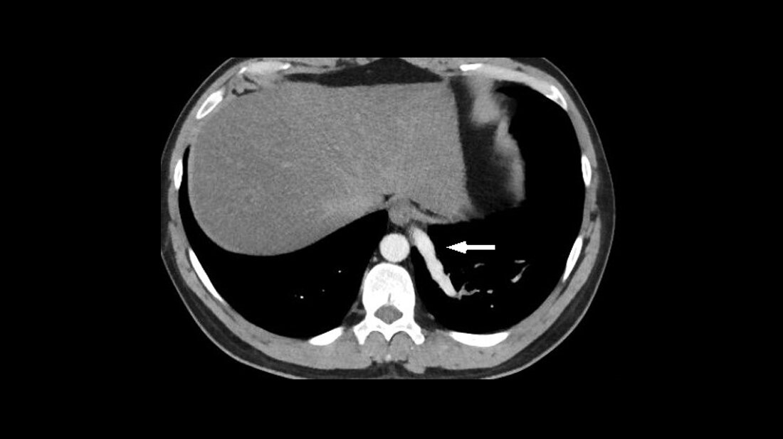 Titelbild des Fachbeitrags zur Bildgebung bei internen vaskulären Malformationen