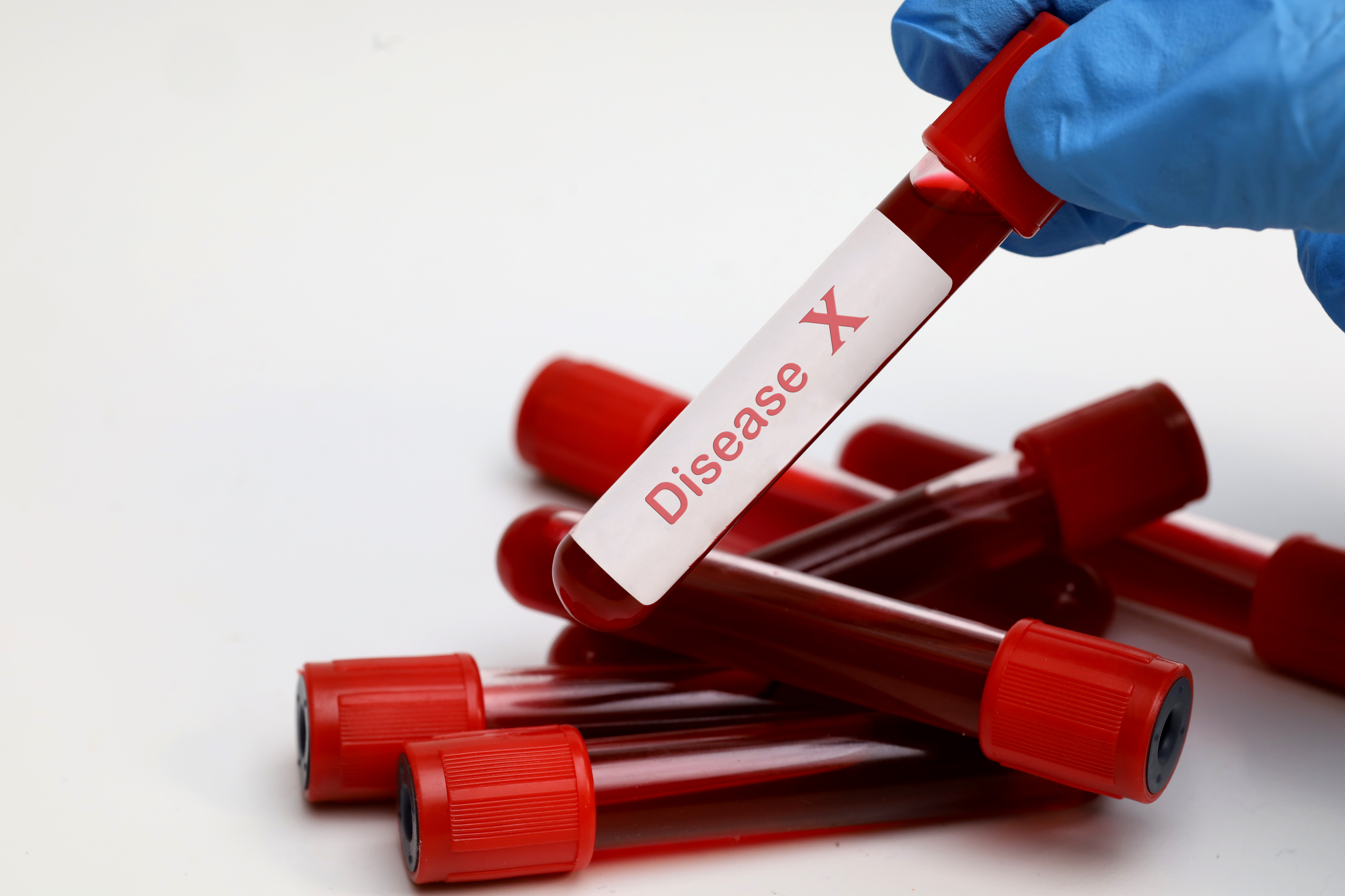 Blutröhrchen mit Aufdruck Disease X