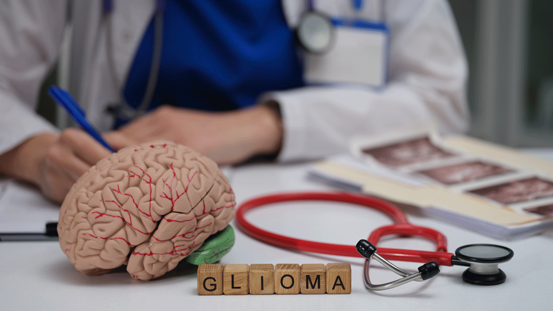 Im Vordergrund liegt ein anatomisches Modell eines Gehirns auf einem Tisch. Davor sind Holzbuchstaben so angeordnet, dass sie das Wort „GLIOMA“ bilden. Rechts daneben liegt ein rotes Stethoskop. Im Hintergrund ist unscharf eine Person in weißem Kittel und blauer Kleidung zu sehen, die etwas notiert. Ebenfalls sichtbar sind medizinische Unterlagen oder Bildaufnahmen auf dem Tisch.
