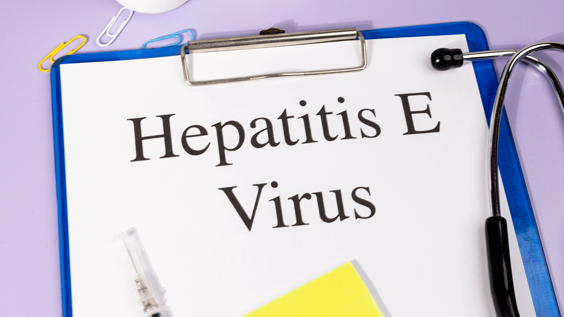 Dieses Bild zeigt ein Klemmbrett mit einem Dokument, auf dem „Hepatitis E Virus“ steht, zusammen mit medizinischen Gegenständen wie einer Spritze, einem Stethoskop und Büroklammern.