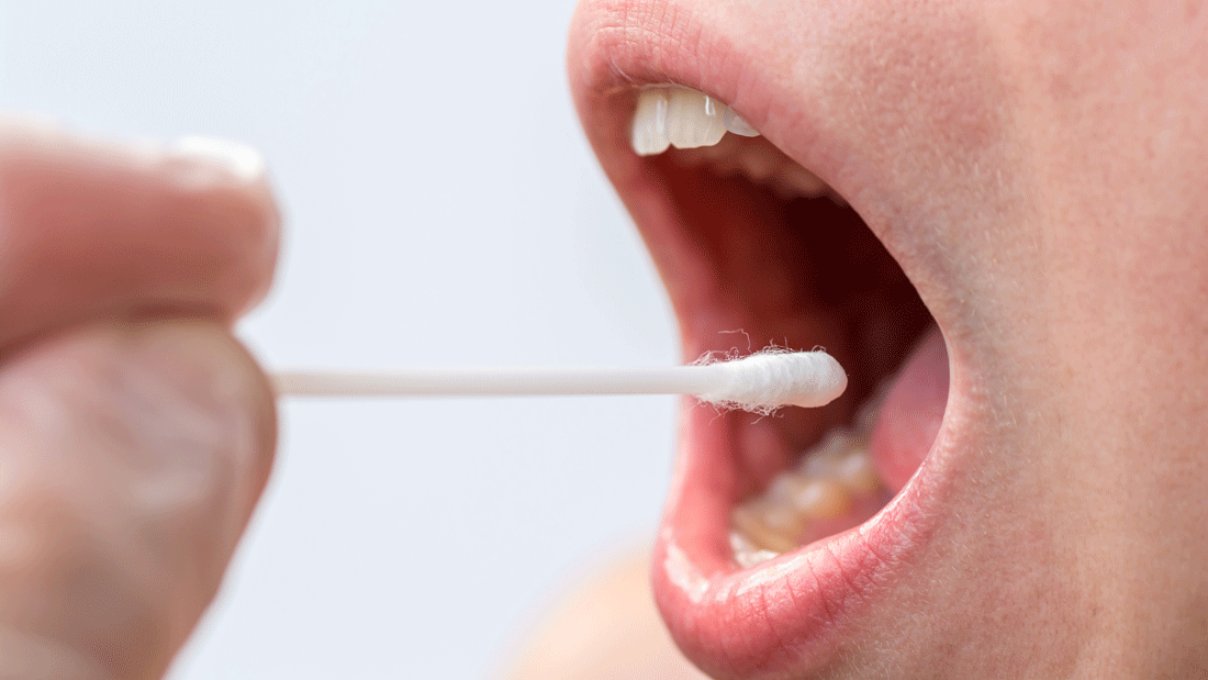 Das Bild zeigt eine medizinische Untersuchung, bei der ein Abstrich aus dem Mund mit einem Wattestäbchen entnommen wird. Damit kann man sich für die Knochenmarkspenderdatei registrieren.