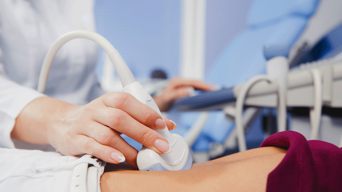 Das Bild zeigt eine Ultraschalluntersuchung, bei der ein medizinisches Gerät auf den Bauch einer Person angewendet wird. 