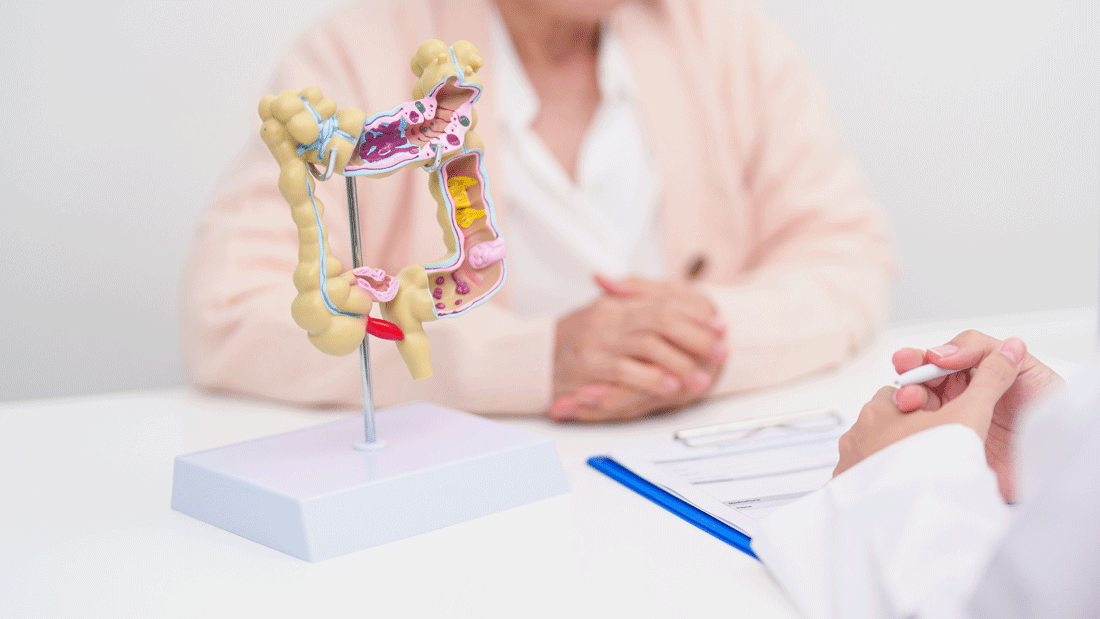 Das Bild zeigt eine medizinische Beratungssituation. Im Vordergrund steht ein anatomisches Modell des Dickdarms beziehungsweise eines Darmabschnitts auf einem Sockel. Rechts unten ist eine Person in weißer Kleidung zu sehen, die einen Stift in der Hand hält. Im Hintergrund sitzt unscharf eine weitere Person an einem Tisch. Auf dem Tisch liegen außerdem Unterlagen auf einem Klemmbrett.