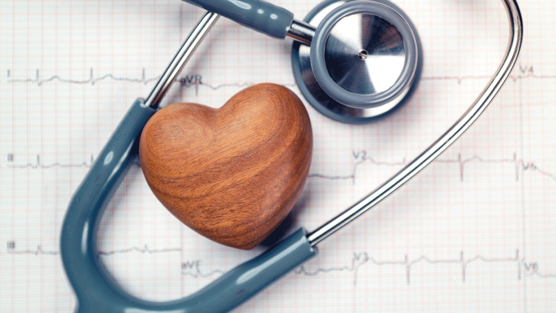 Stethoskop und kleines Holzherz liegen auf einem EKG-Ausdruck.