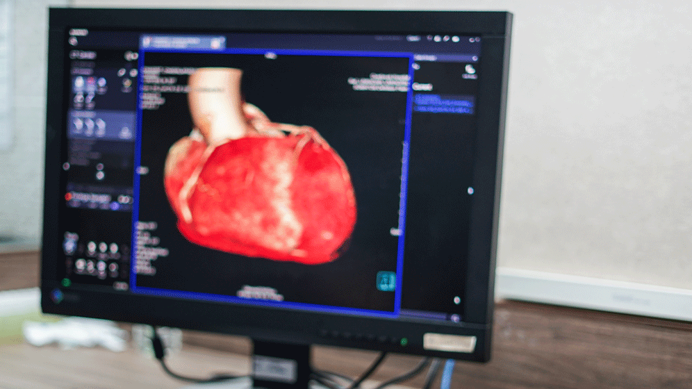 AdobeStock_233203309.gif Bildgebung des Herzens