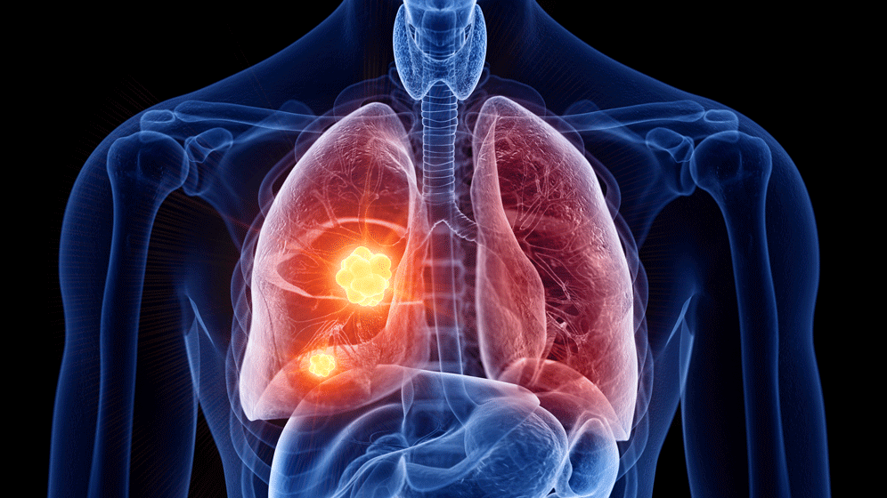 Krebszellen im Schlummerzustand