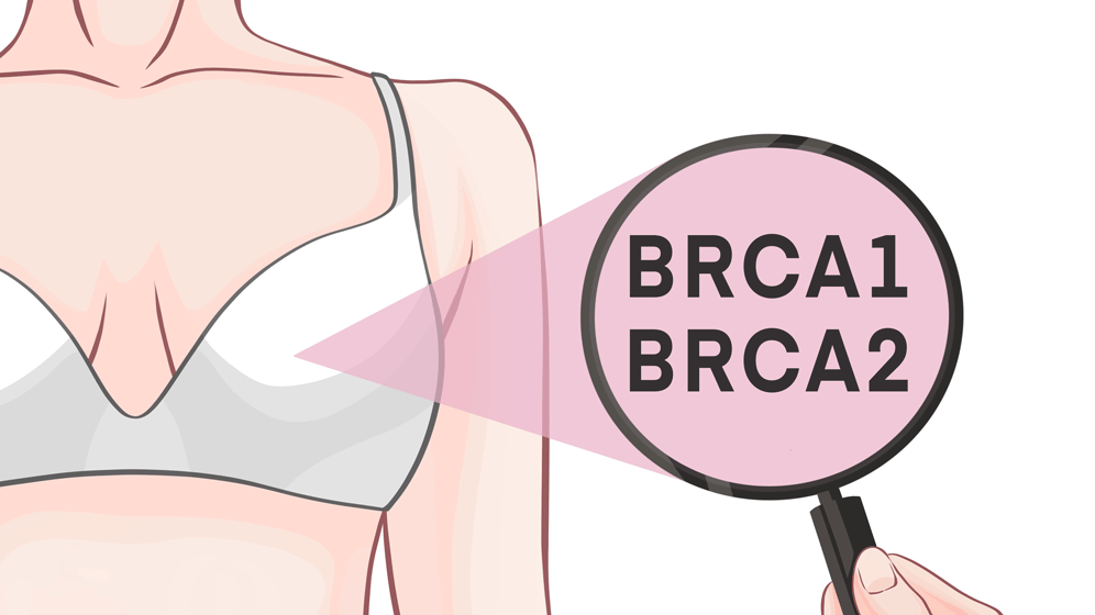 AdobeStock_292894476.gif Erblicher Brustkrebs