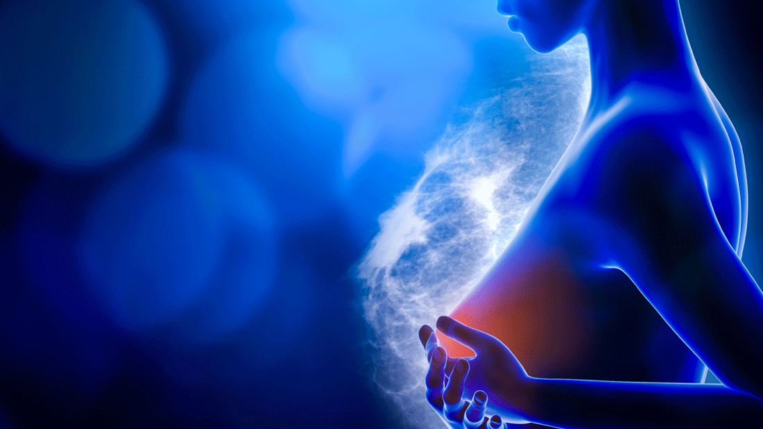 Dieses Bild zeigt eine medizinische oder wissenschaftliche Darstellung im Zusammenhang mit der Gesundheit der Brust, möglicherweise im Kontext von Mammographie oder Brustkrebsaufklärung.