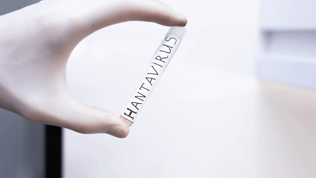Dieses Bild zeigt eine behandschuhte Hand, die ein Reagenzglas mit der Aufschrift „HANTAVIRUS“ hält. 