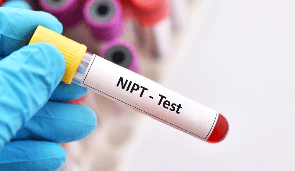 AdobeStock_343874489.gif NIPT