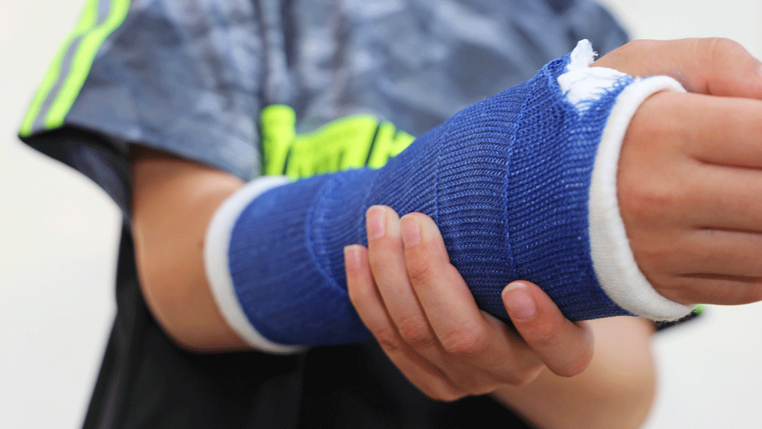 Kind hält einen Arm mit blauem Gipsverband.