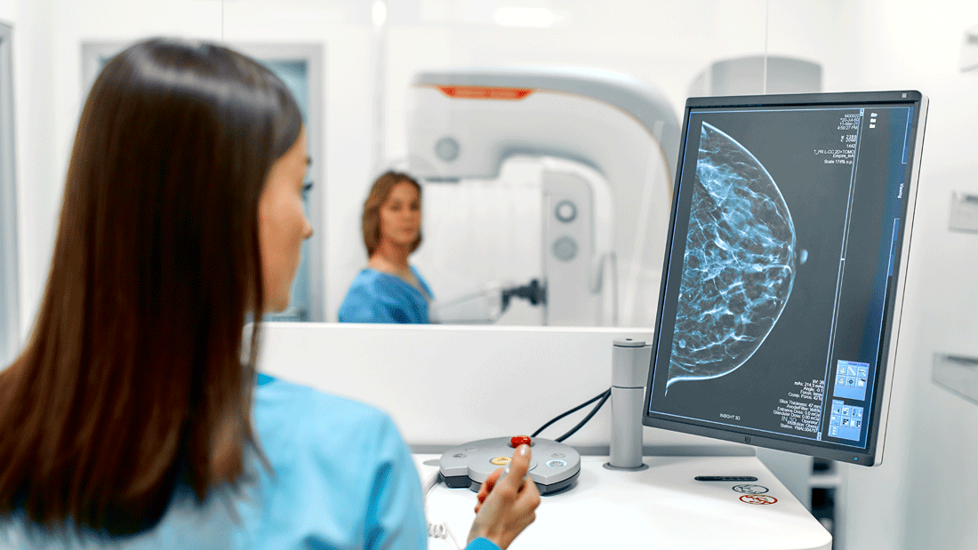 Fachkraft steuert in einem Untersuchungsraum ein Mammographiegerät; auf dem Monitor ist eine Brustaufnahme zu sehen. Im Hintergrund steht eine Patientin an der Apparatur.