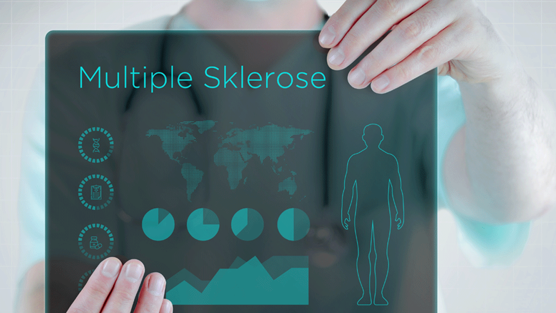 Das Bild zeigt eine medizinische Darstellung mit dem Titel „Multiple Sklerose". Es enthält grafische Elemente wie Diagramme, eine Weltkarte, ein menschliches Silhouettenmodell und Symbole, die auf genetische, diagnostische und therapeutische Aspekte hinweisen könnten.