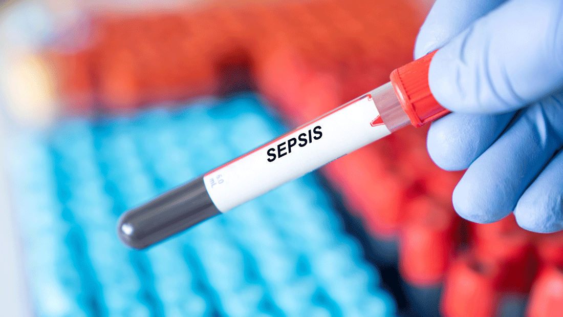 Sepsis-Bluttest in der Hand eines Arztes