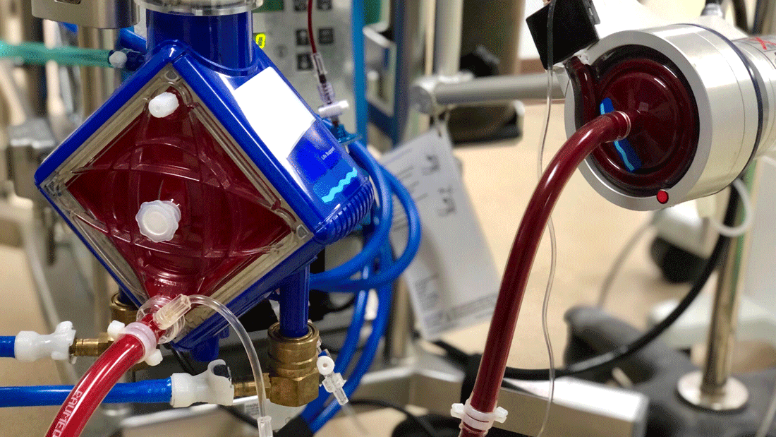 Das Bild zeigt eine medizinische Maschine, die Teil eines extrakorporalen Kreislaufsystems ist (extrakorporale Membranoxygenierung, ECMO).